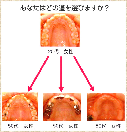 あなたはどの道を選びますか？