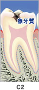 C2