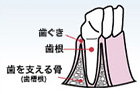 健康な歯の周りの組織