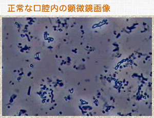 正常な口腔内の顕微鏡画像