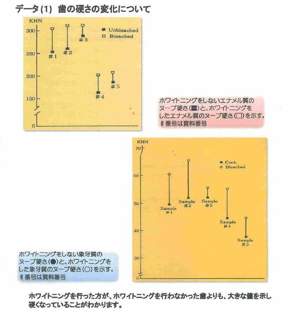 ホワイトニング