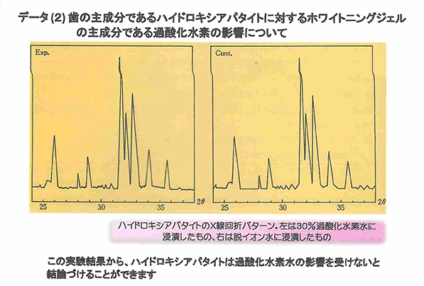 ホワイトニング